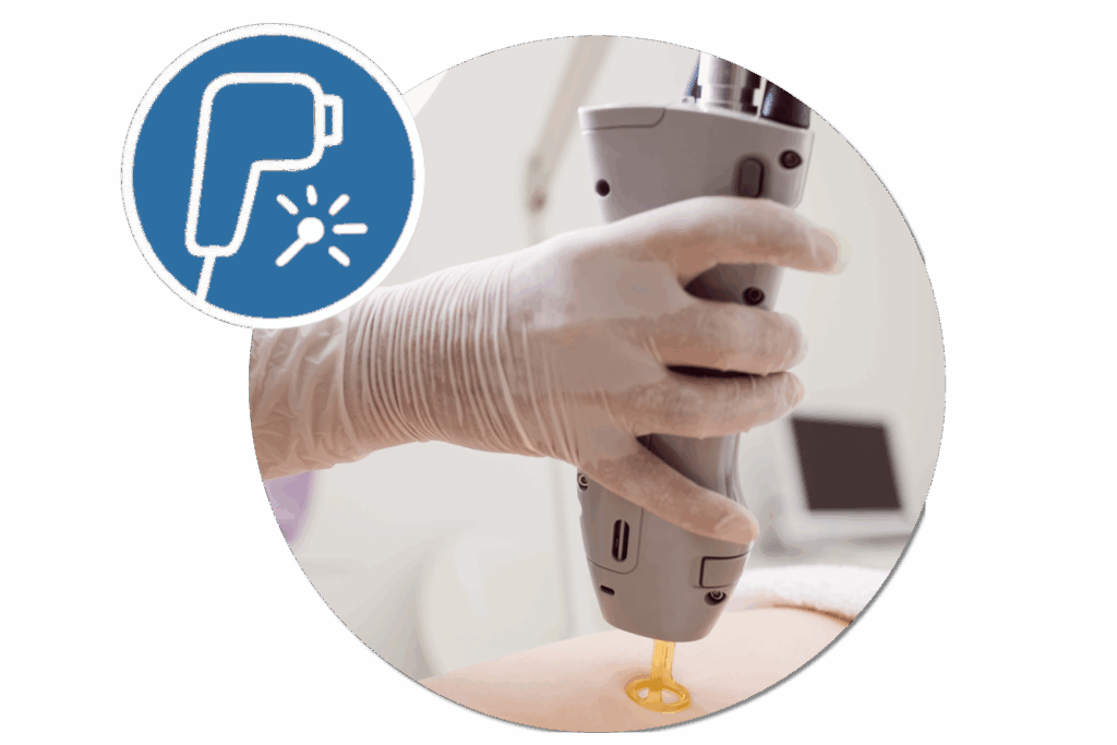 laseroterapia antiaging