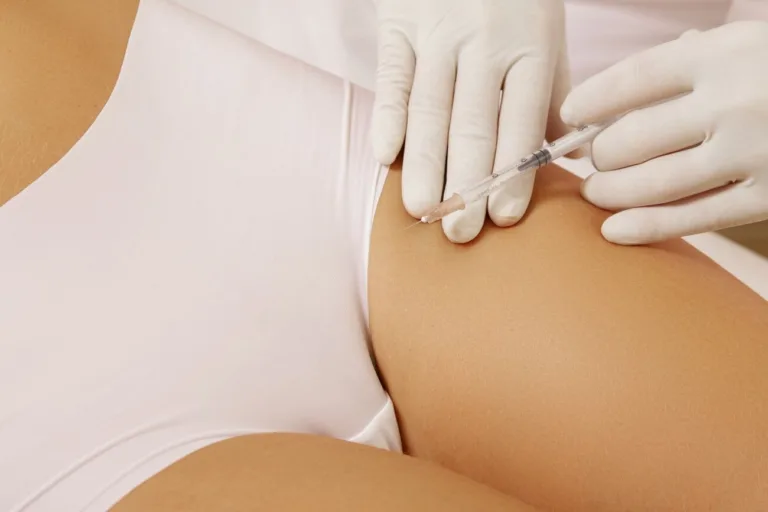 Mezoterapia okolic intymnych